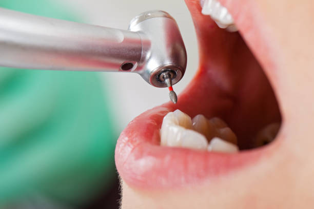 Urgent Tooth Repair in ID